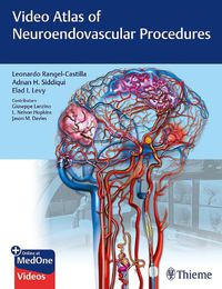 Cover image for Video Atlas of Neuroendovascular Procedures