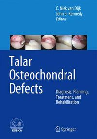 Cover image for Talar Osteochondral Defects: Diagnosis, Planning, Treatment, and Rehabilitation