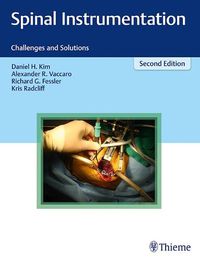 Cover image for Spinal Instrumentation: Challenges and Solutions
