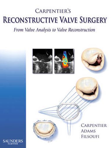 Cover image for Carpentier's Reconstructive Valve Surgery