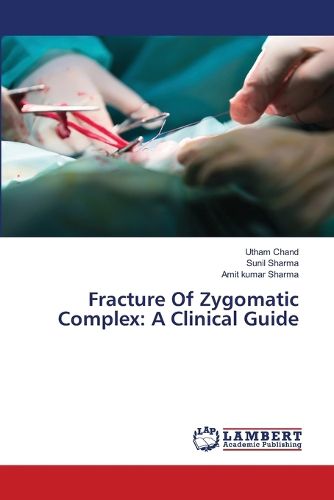 Cover image for Fracture Of Zygomatic Complex