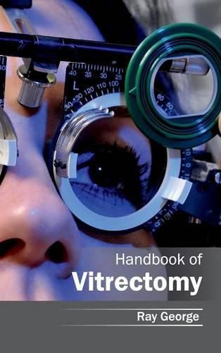 Cover image for Handbook of Vitrectomy