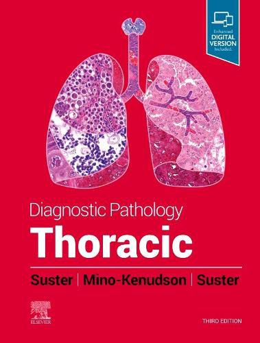 Cover image for Diagnostic Pathology: Thoracic