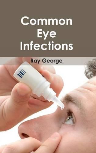 Cover image for Common Eye Infections