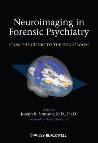 Cover image for Neuroimaging in Forensic Psychiatry: from the Clinic to the Courtroom