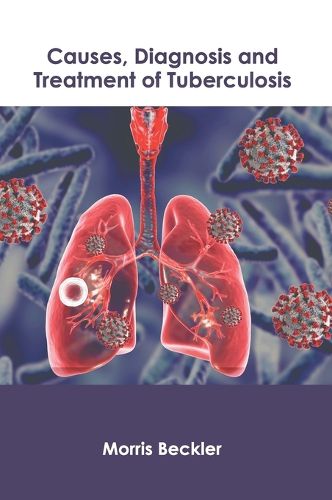 Cover image for Causes, Diagnosis and Treatment of Tuberculosis