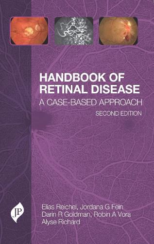 Cover image for Handbook of Retinal Disease