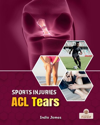 Cover image for ACL Tears