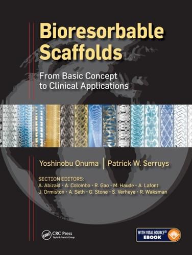 Cover image for Bioresorbable Scaffolds: From Basic Concept to Clinical Applications