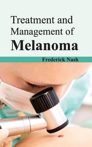 Cover image for Treatment and Management of Melanoma