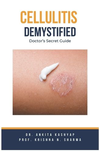 Cellulitis Demystified