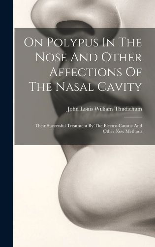 Cover image for On Polypus In The Nose And Other Affections Of The Nasal Cavity