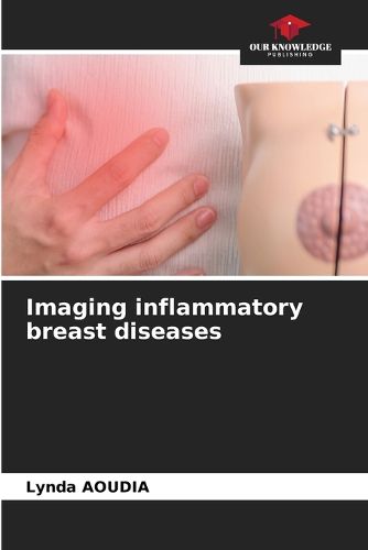 Cover image for Imaging inflammatory breast diseases