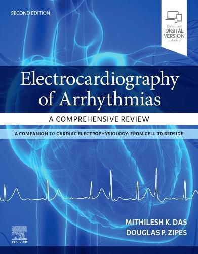 Cover image for Electrocardiography of Arrhythmias: A Comprehensive Review