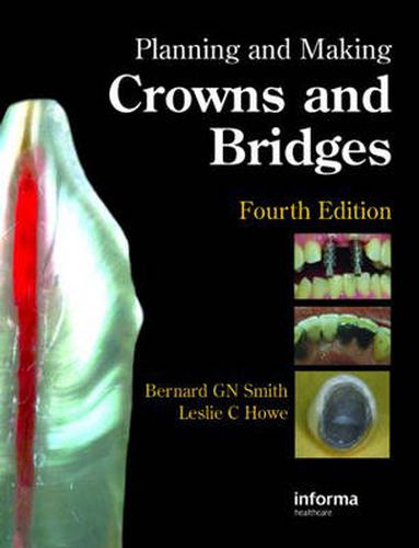 Cover image for Planning and Making Crowns and Bridges