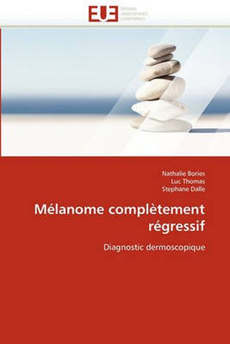 Cover image for M Lanome Compl Tement R Gressif