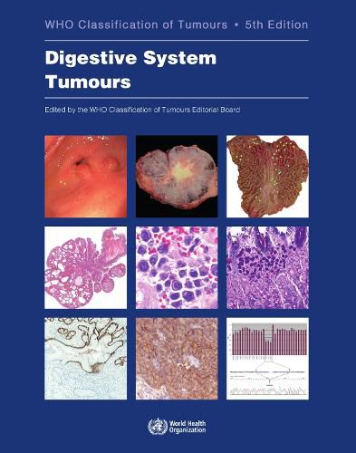 WHO Classification of Tumours. Digestive System Tumours: WHO Classification of Tumours, Volume 1