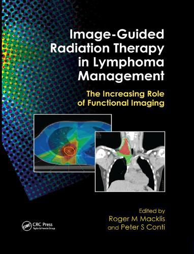 Cover image for Image-Guided Radiation Therapy in Lymphoma Management: The Increasing Role of Functional Imaging