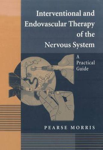 Cover image for Interventional and Endovascular Therapy of the Nervous System: A Practical Guide