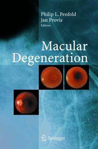 Cover image for Macular Degeneration