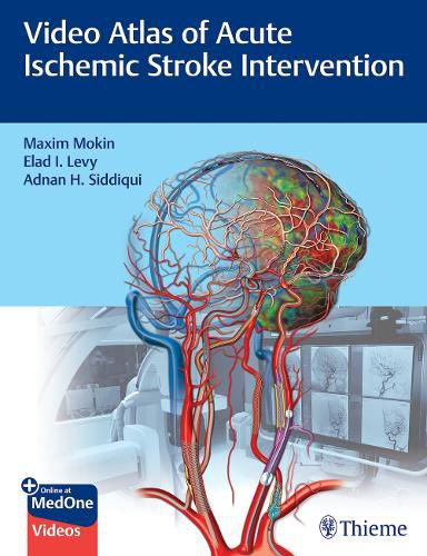 Cover image for Video Atlas of Acute Ischemic Stroke Intervention