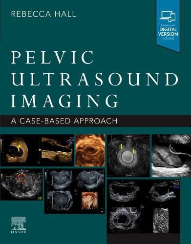 Cover image for Pelvic Ultrasound Imaging: a Cased-Based Application