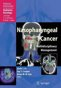 Cover image for Nasopharyngeal Cancer: Multidisciplinary Management