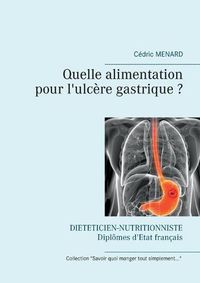 Cover image for Quelle alimentation pour l'ulcere gastrique ?