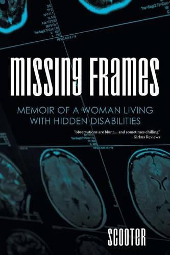 Cover image for Missing Frames