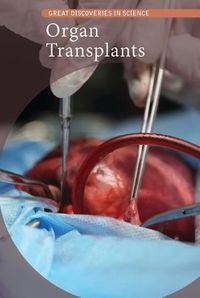 Cover image for Organ Transplants
