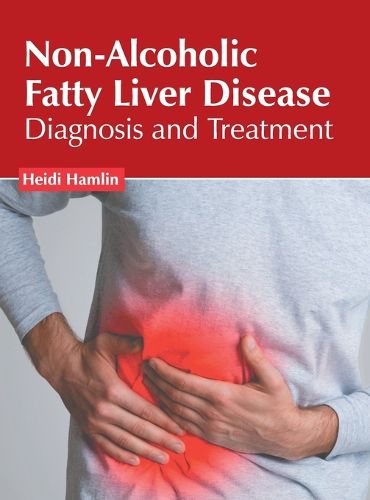 Cover image for Non-Alcoholic Fatty Liver Disease: Diagnosis and Treatment