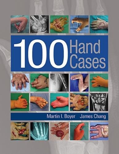 Cover image for 100 Hand Cases
