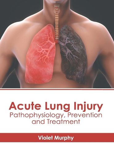 Cover image for Acute Lung Injury: Pathophysiology, Prevention and Treatment
