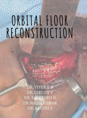 Cover image for Orbital floor reconstruction