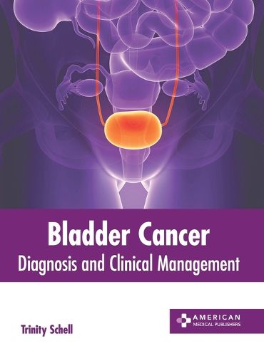 Cover image for Bladder Cancer: Diagnosis and Clinical Management