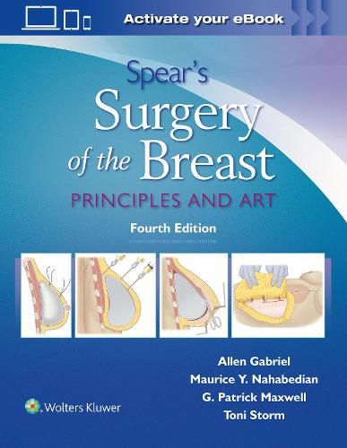 Cover image for Spear's Surgery of the Breast: Principles and Art