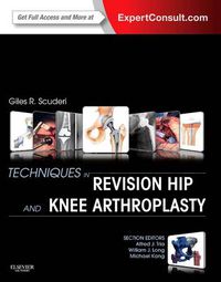 Cover image for Techniques in Revision Hip and Knee Arthroplasty