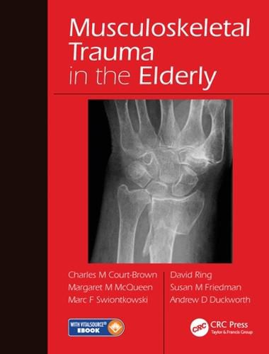 Musculoskeletal Trauma in the Elderly