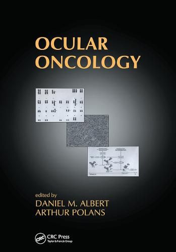 Cover image for Ocular Oncology