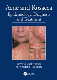 Cover image for Acne and Rosacea: Epidemiology, Diagnosis and Treatment