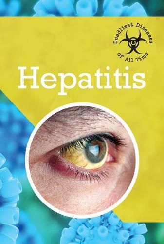 Cover image for Hepatitis