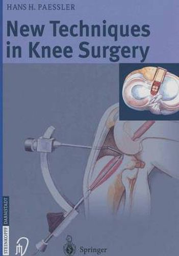 Cover image for New Techniques in Knee Surgery