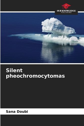 Cover image for Silent pheochromocytomas