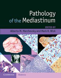 Cover image for Pathology of the Mediastinum