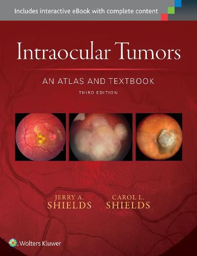 Intraocular Tumors: An Atlas and Textbook