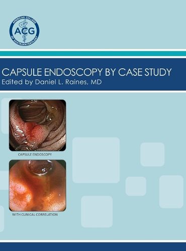 Cover image for Capsule Endoscopy by Case Study, Volume 2