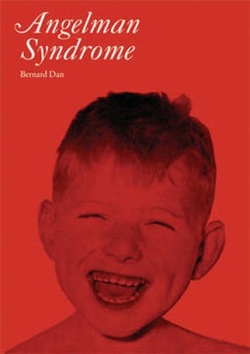 Cover image for Angelman's Syndrome