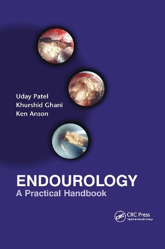 Cover image for Endourology: A Practical Handbook