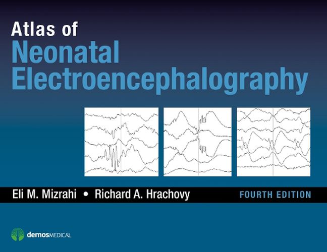 Cover image for Atlas of Neonatal Electroencephalography