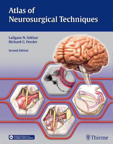 Cover image for Atlas of Neurosurgical Techniques: Brain